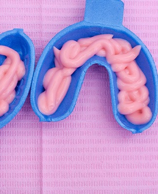 Fluoride treatment in mouth trays