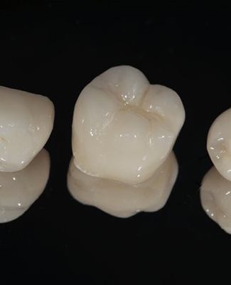 three dental crowns in Federal Way against black background 