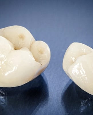 porcelain dental crowns