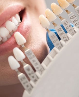 dentist matching the shade of a patient’s tooth