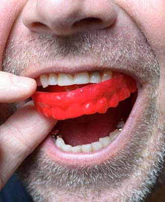 man putting a red mouthguard over his teeth 