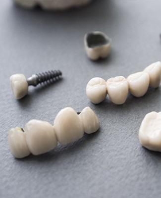 several dental implants attached to crowns and bridges