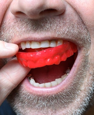 man putting a red mouthguard into his mouth