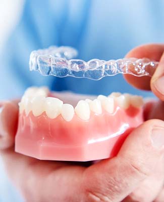 Dentist in Federal Way placing Invisalign tray over model of teeth