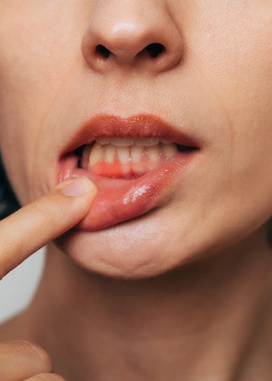 Woman with gum irritation