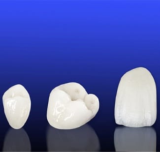 all-ceramic dental crowns