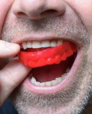 red mouthguard