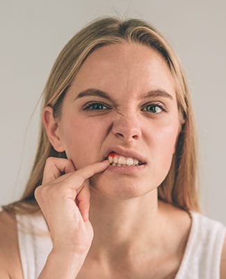 woman with red gums