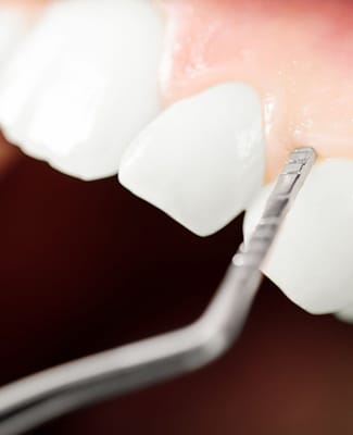 dental instrument touching gums