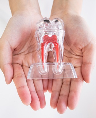 Emergency dentist in Federal Way holding model of a tooth