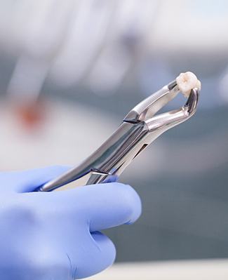 Dentist holding an extracted tooth with forceps