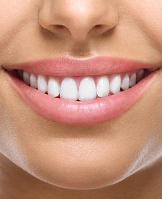 Woman’s beautiful smile after teeth whitening in Federal Way