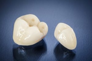Image of all-ceramic dental crowns in Federal Way.