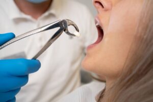 Woman getting her tooth pulled to protect her smile